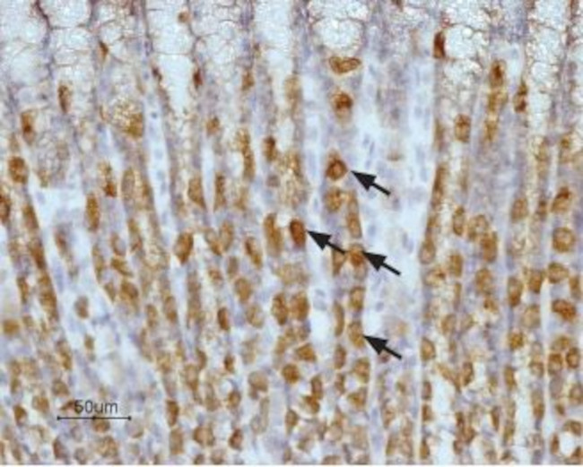 Histamine H2 Receptor (HRH2) (extracellular) Antibody in Immunohistochemistry (Paraffin) (IHC (P))