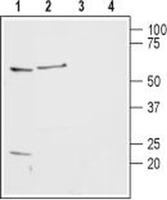 Histamine H2 Receptor (HRH2) (extracellular) Antibody in Western Blot (WB)