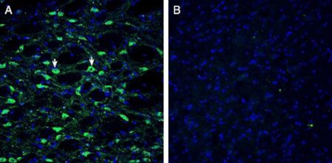 Histamine H1 Receptor/HRH1 (extracellular) Antibody in Immunohistochemistry (Frozen) (IHC (F))