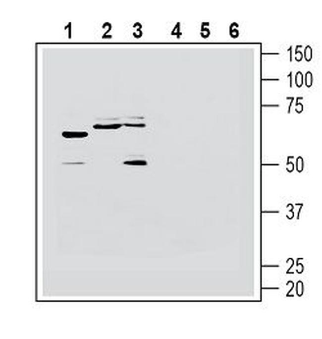 Histamine H1 Receptor/HRH1 (extracellular) Antibody in Western Blot (WB)