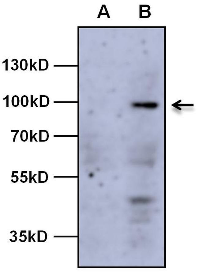 AHR Antibody in Western Blot (WB)