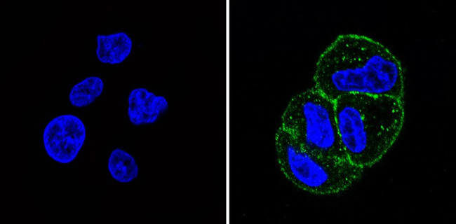 INSR alpha Antibody in Immunocytochemistry (ICC/IF)