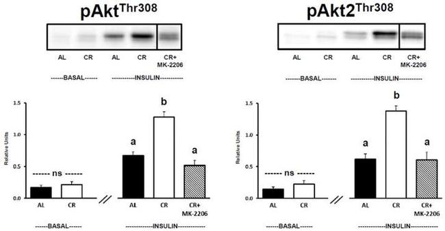 INSR beta Antibody in Western Blot (WB)