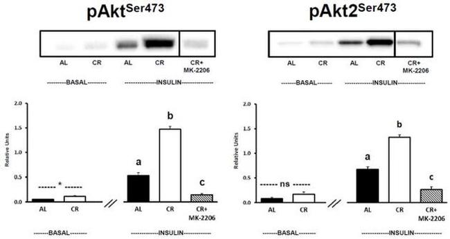 INSR beta Antibody in Western Blot (WB)