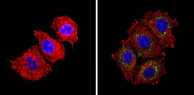 INSR beta Antibody in Immunocytochemistry (ICC/IF)