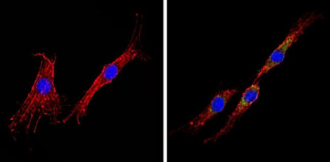 INSR beta Antibody in Immunocytochemistry (ICC/IF)