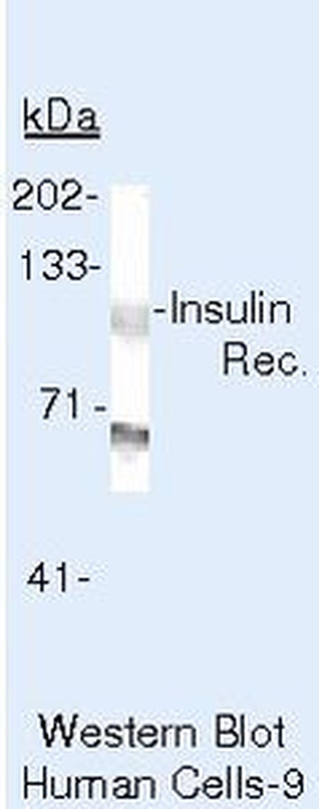 INSR beta Antibody in Western Blot (WB)