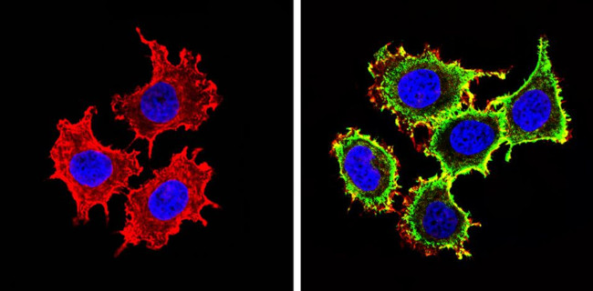 IGF1R alpha Antibody in Immunocytochemistry (ICC/IF)