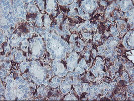 AHSG Antibody in Immunohistochemistry (Paraffin) (IHC (P))