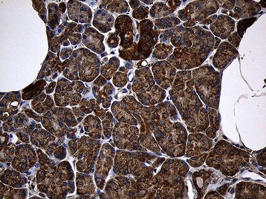 AIFM1 Antibody in Immunohistochemistry (Paraffin) (IHC (P))