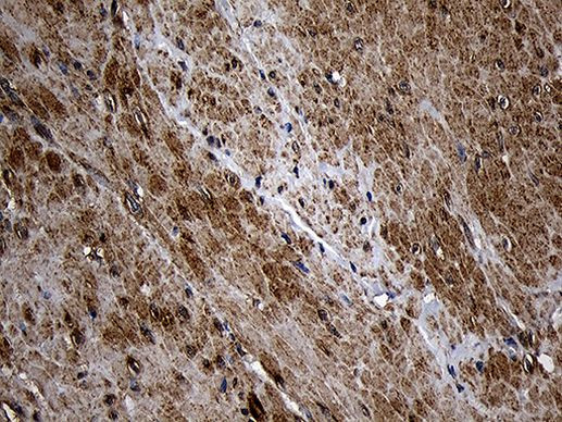 AIFM1 Antibody in Immunohistochemistry (Paraffin) (IHC (P))