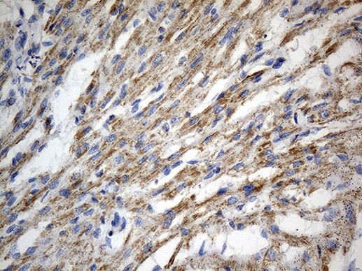 AIFM1 Antibody in Immunohistochemistry (Paraffin) (IHC (P))