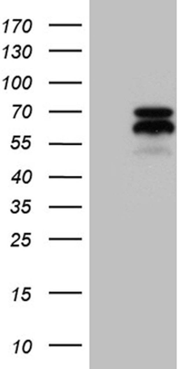 AIFM1 Antibody in Western Blot (WB)