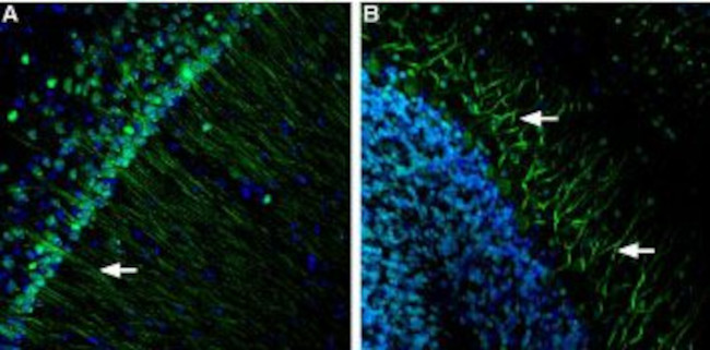 Presenilin-1 Antibody in Immunohistochemistry (IHC)