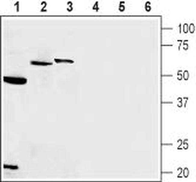 Presenilin-1 Antibody in Western Blot (WB)