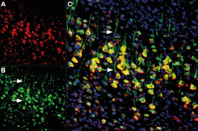 Presenilin-1 Antibody in Immunohistochemistry (Frozen) (IHC (F))