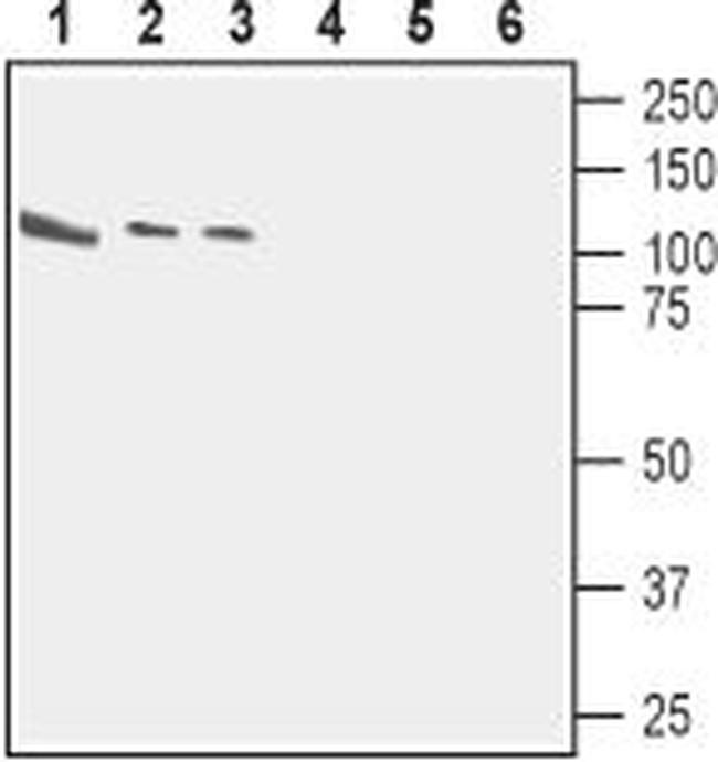 CASK Antibody in Western Blot (WB)