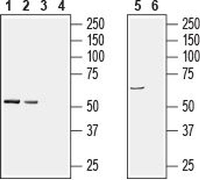 PACSIN1 Antibody in Western Blot (WB)