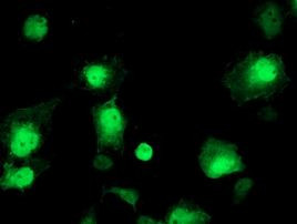 AIPL1 Antibody in Immunocytochemistry (ICC/IF)