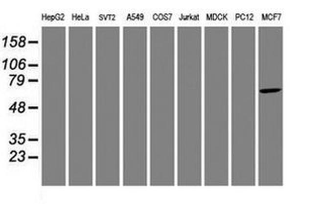 AIPL1 Antibody in Western Blot (WB)