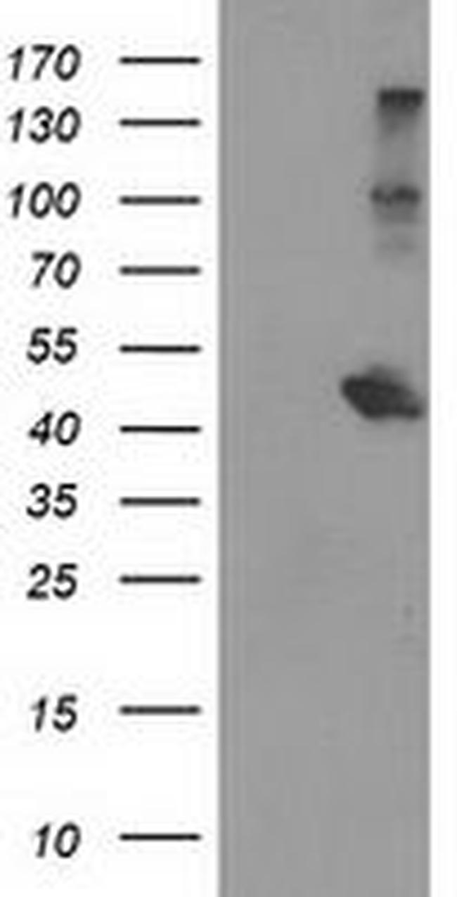 AIPL1 Antibody in Western Blot (WB)