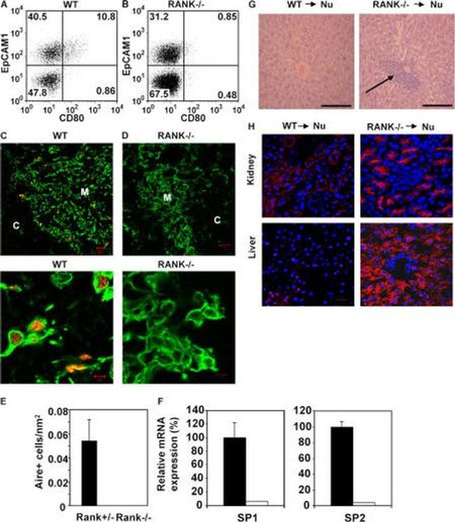 AIRE Antibody in Immunohistochemistry (IHC)