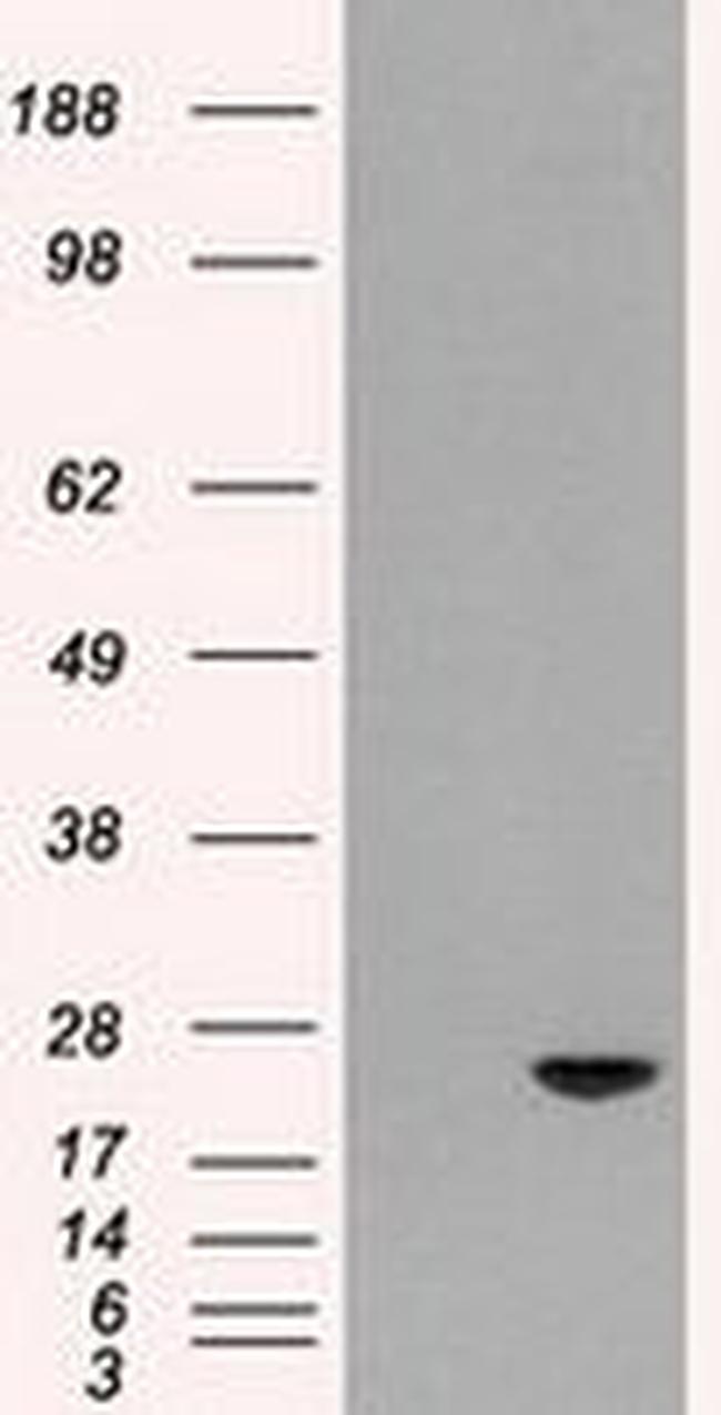 AK1 Antibody in Western Blot (WB)