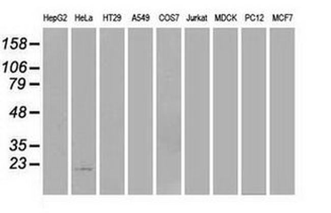 AK1 Antibody in Western Blot (WB)