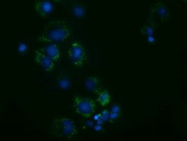 AK3 Antibody in Immunocytochemistry (ICC/IF)