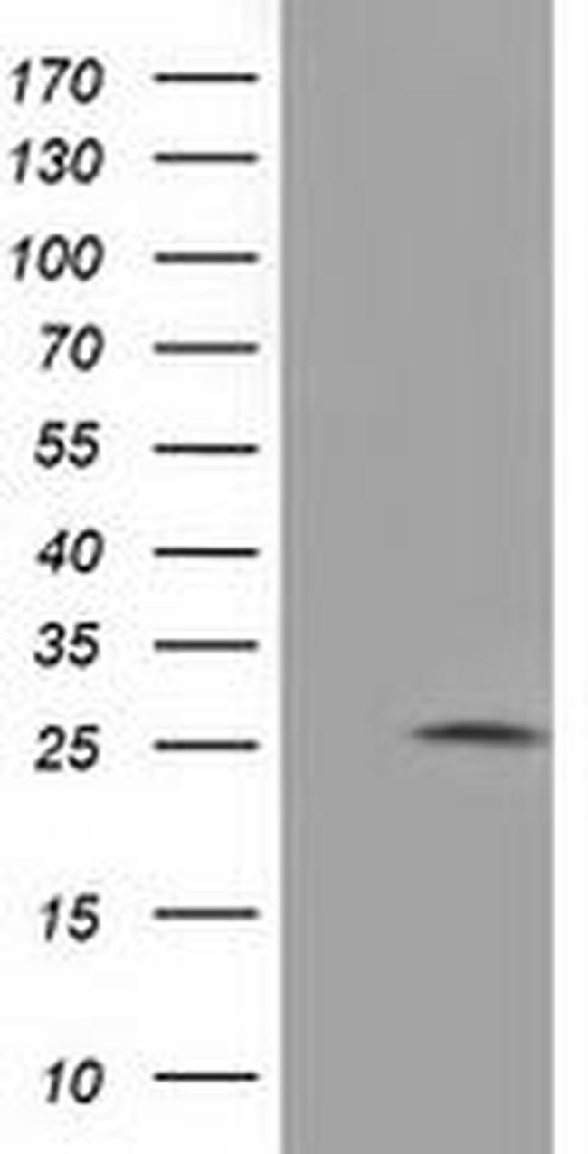 AK3 Antibody in Western Blot (WB)