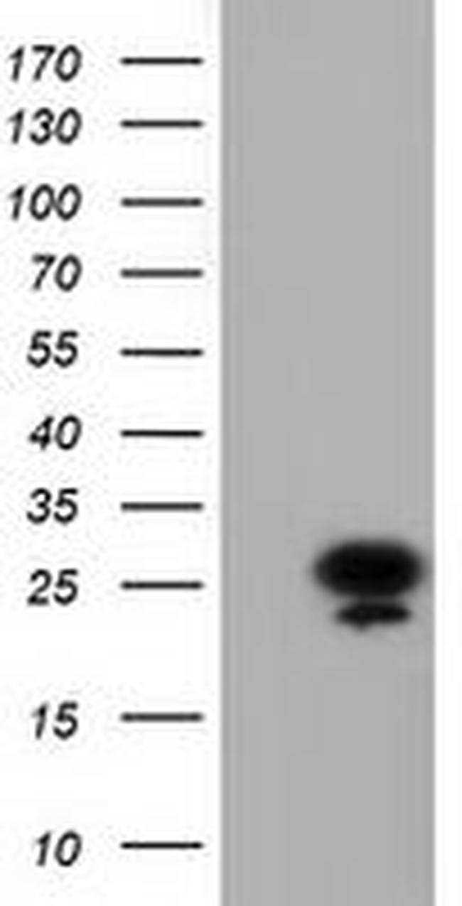 AK3 Antibody in Western Blot (WB)