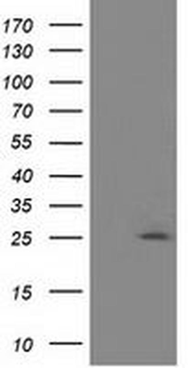 AK3 Antibody in Western Blot (WB)