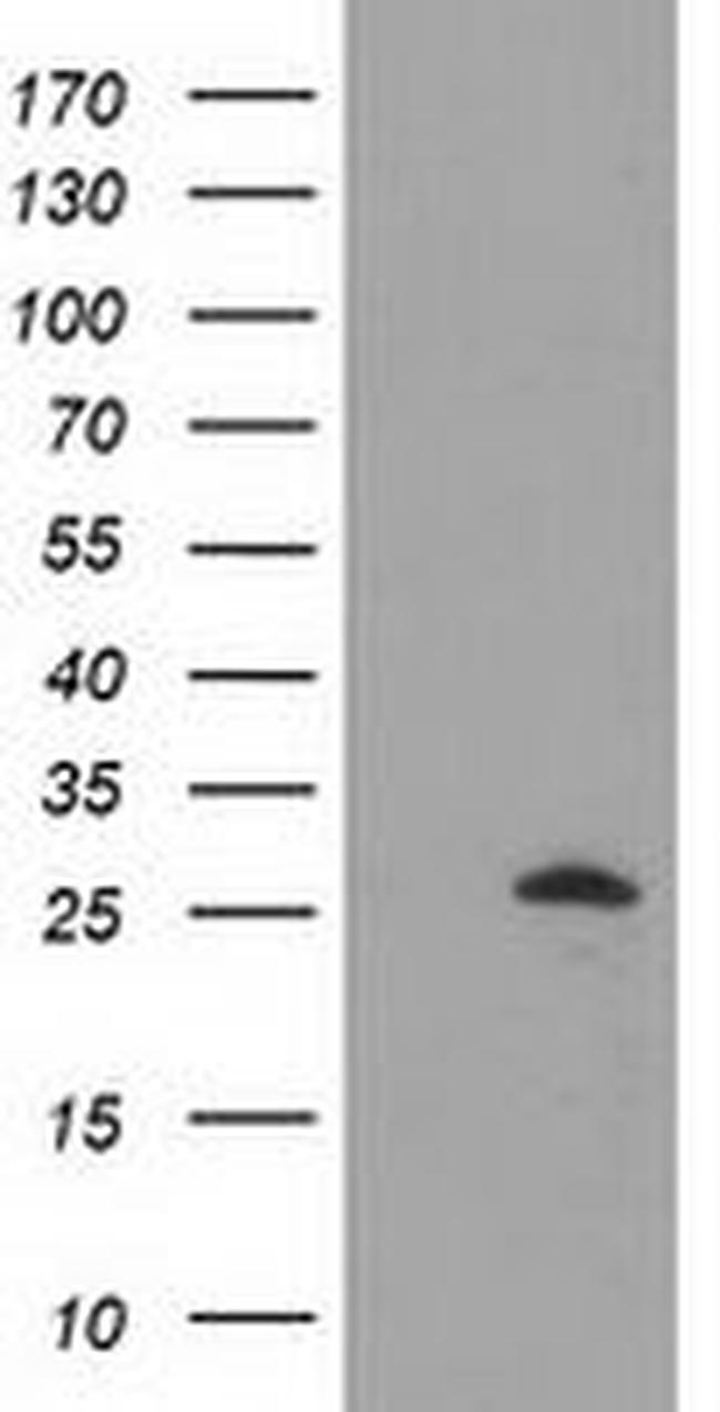 AK3 Antibody in Western Blot (WB)