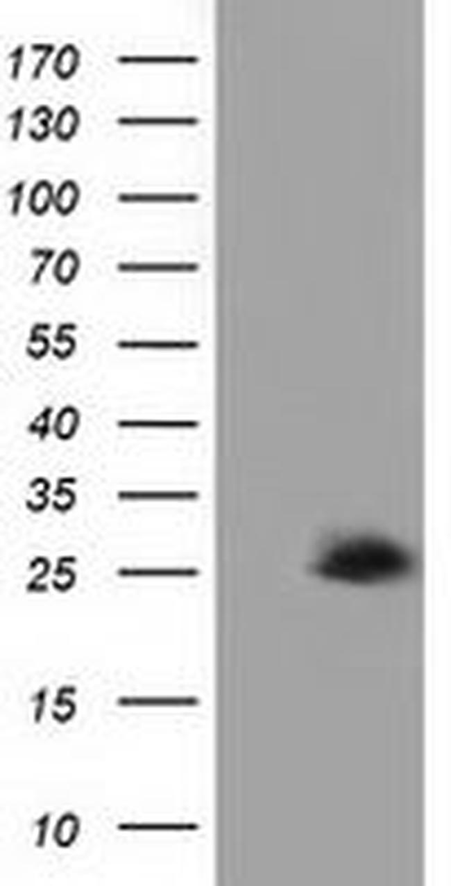 AK3 Antibody in Western Blot (WB)