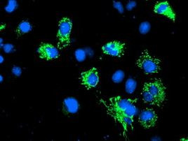 AK4 Antibody in Immunocytochemistry (ICC/IF)