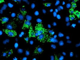 AK4 Antibody in Immunocytochemistry (ICC/IF)