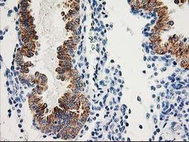 AK4 Antibody in Immunohistochemistry (Paraffin) (IHC (P))