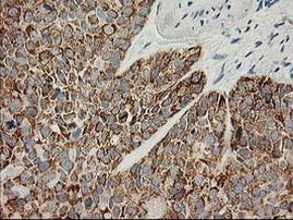 AK4 Antibody in Immunohistochemistry (Paraffin) (IHC (P))