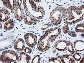 AK4 Antibody in Immunohistochemistry (Paraffin) (IHC (P))