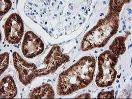 AK4 Antibody in Immunohistochemistry (Paraffin) (IHC (P))