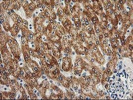 AK4 Antibody in Immunohistochemistry (Paraffin) (IHC (P))