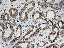 AK4 Antibody in Immunohistochemistry (Paraffin) (IHC (P))