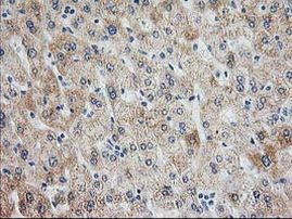 AK4 Antibody in Immunohistochemistry (Paraffin) (IHC (P))