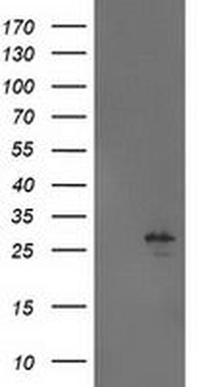 AK4 Antibody in Western Blot (WB)