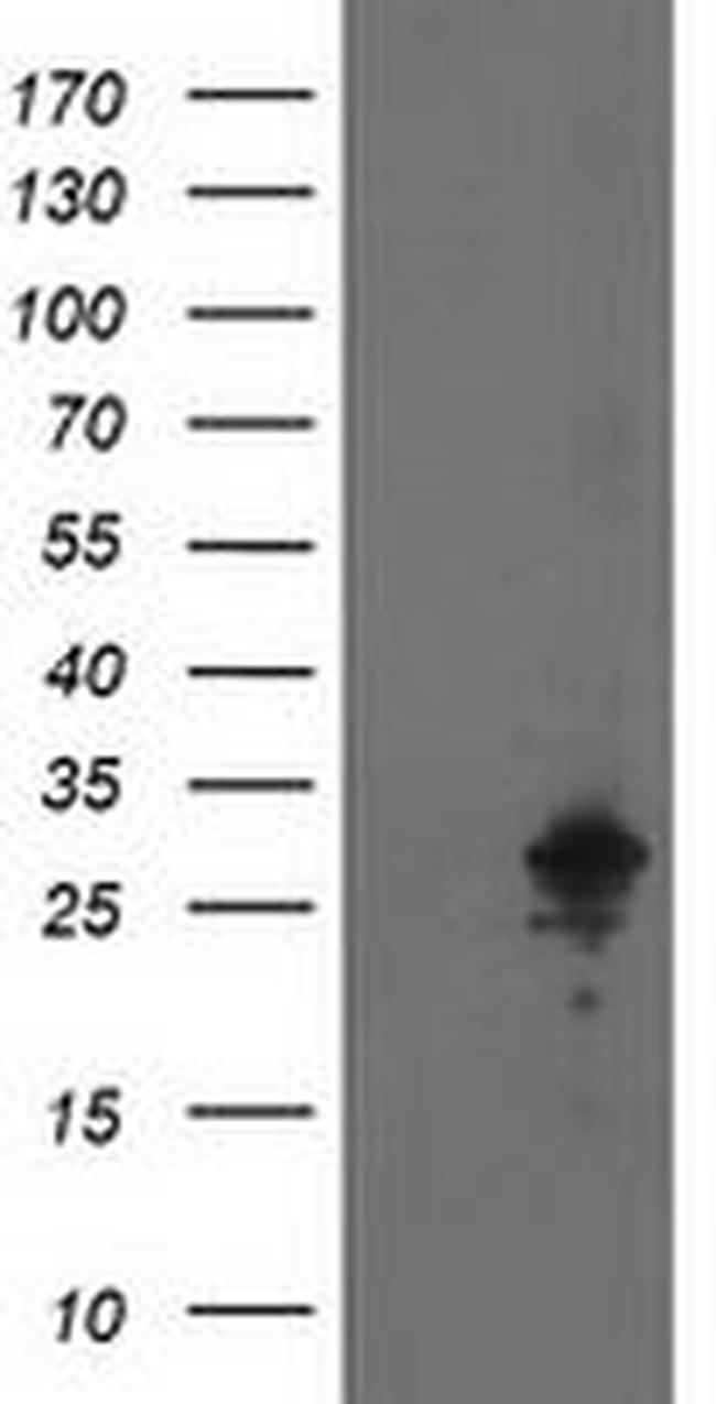 AK4 Antibody in Western Blot (WB)