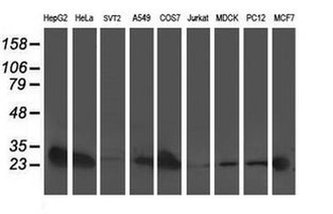 AK4 Antibody in Western Blot (WB)