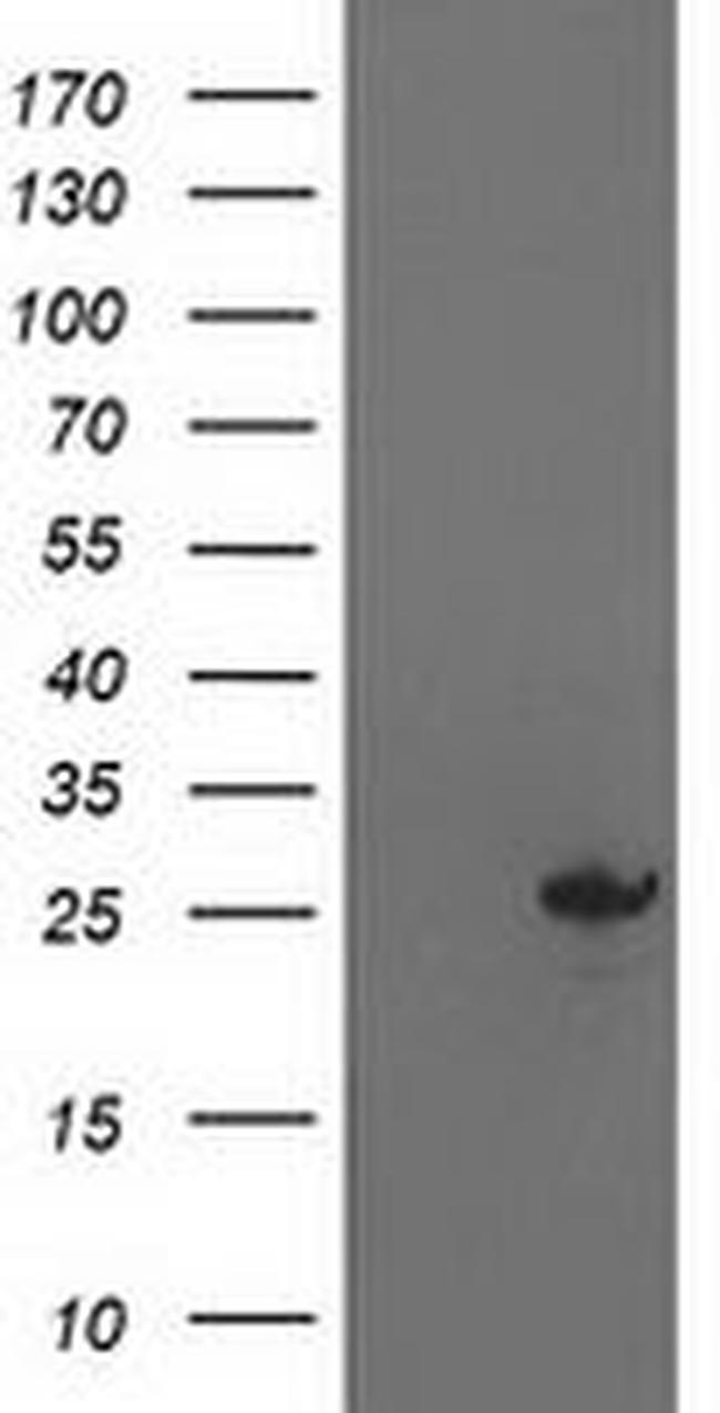 AK4 Antibody in Western Blot (WB)