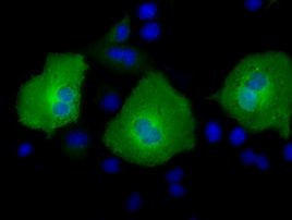 AK5 Antibody in Immunocytochemistry (ICC/IF)