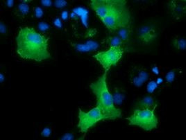 AK5 Antibody in Immunocytochemistry (ICC/IF)