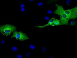 AK5 Antibody in Immunocytochemistry (ICC/IF)